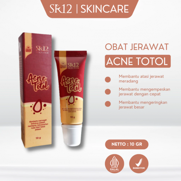 Acne Totol
