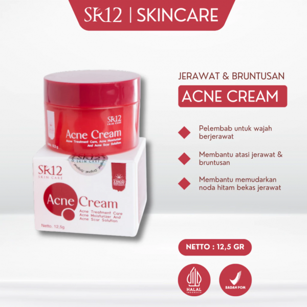 Acne Cream
